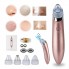 Вакуумный аппарат для чистки лица, очиститель пор кожи Menqahahayd XN-8030 Pink USB, 5 режимов + 4 насадки в подарок (SO-7950 YS)