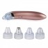 Вакуумный аппарат для чистки лица, очиститель пор кожи Menqahahayd XN-8030 Pink USB, 5 режимов + 4 насадки в подарок (SO-7950 YS)